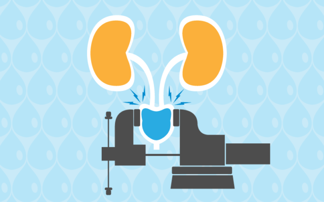 Stress incontinence is the involuntarily leakage of urine when extra pressure or force is put on the bladder HCD health