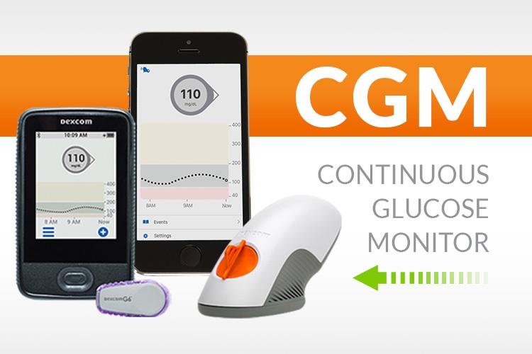 CGM - Continuous Glucose Monitors