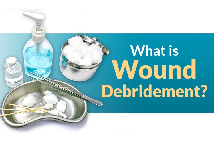 What is Wound Debridement?