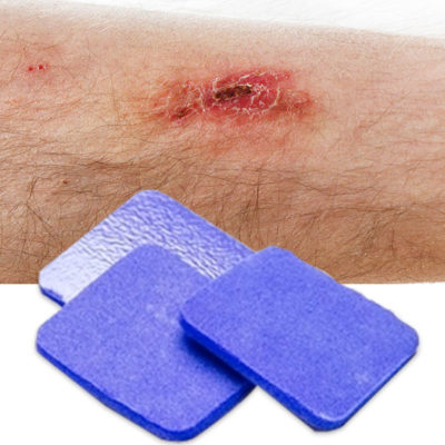 foam dressing and example wound