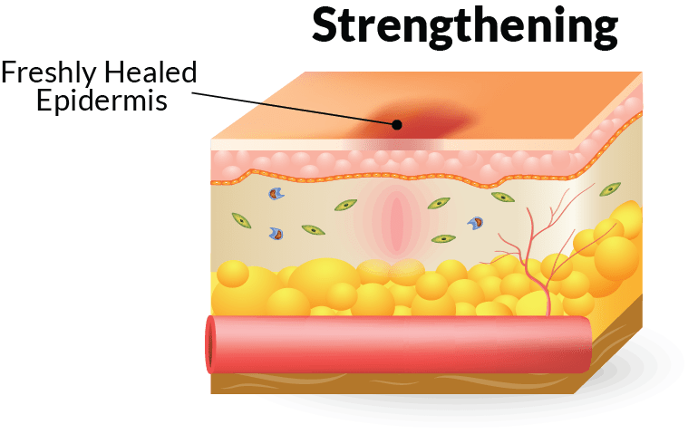 Stage of wound healing - strengthening
