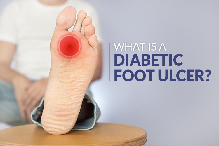 What is a diabetic foot ulcer?