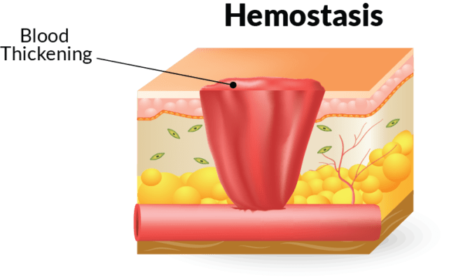 Stage of wound healing - hemostasis