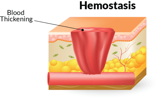 The Four Stages Of Wound Healing And How To Treat Them—home Care Delivered