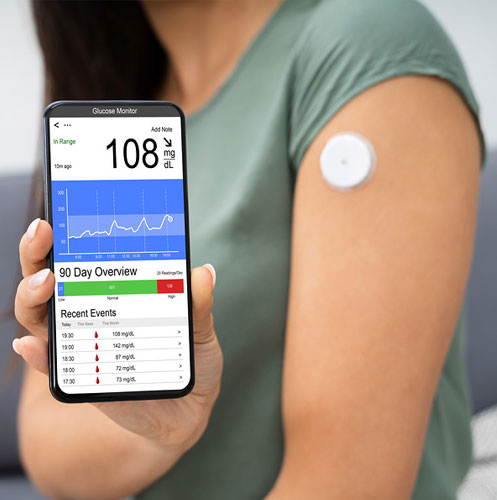 cgm sensor on arm with a smart phone cgm sensor on arm with a smart phone