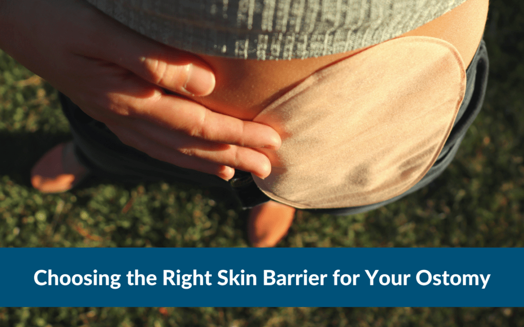 Choosing the Right Skin Barrier for Your Ostomy