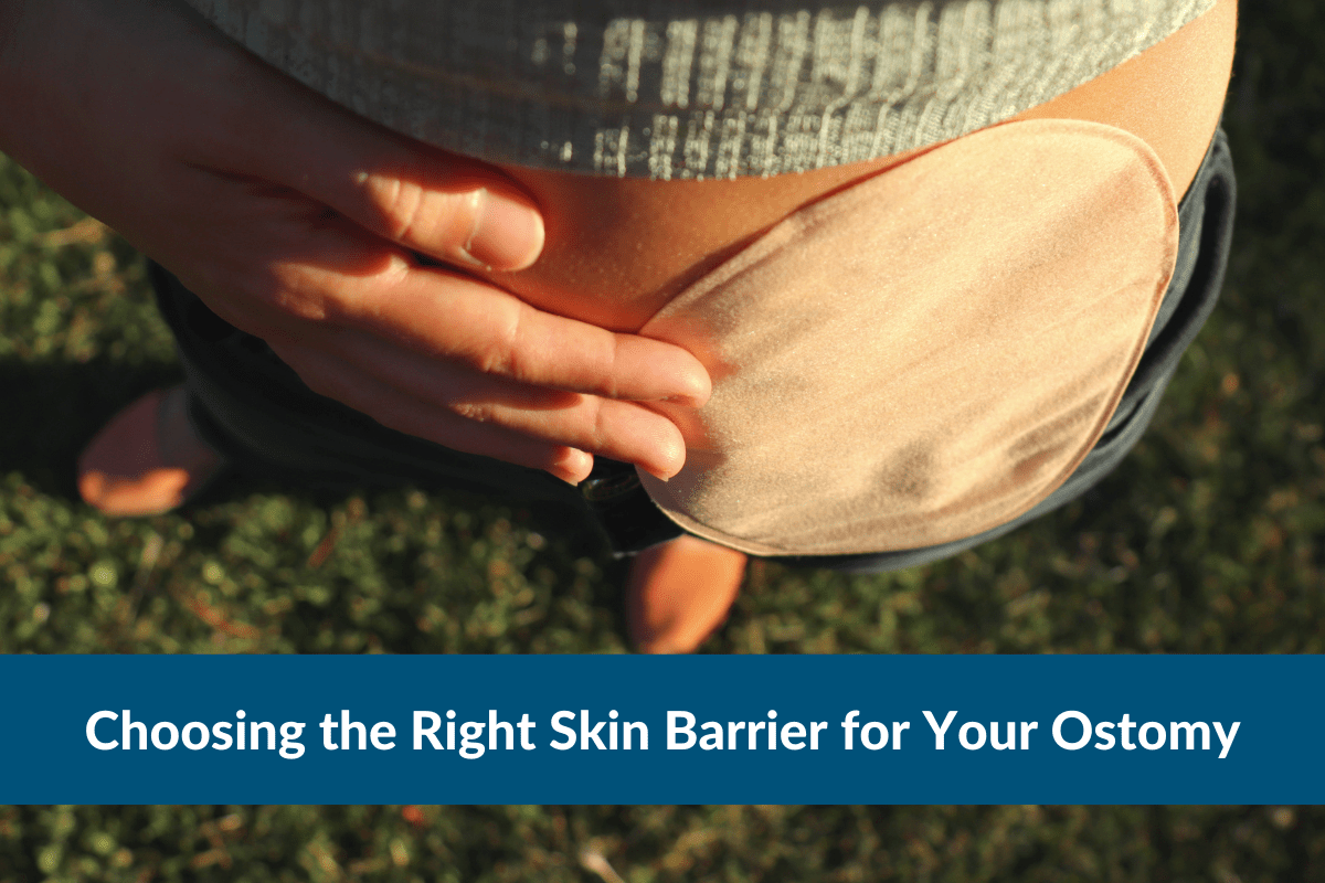 Choosing the Right Ostomy Skin Barrier