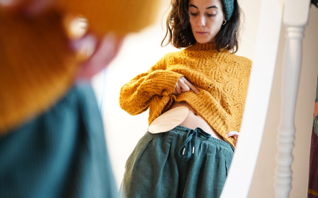 The Importance and Variety of Ostomy Products: Helping Patients Find the Right Fit